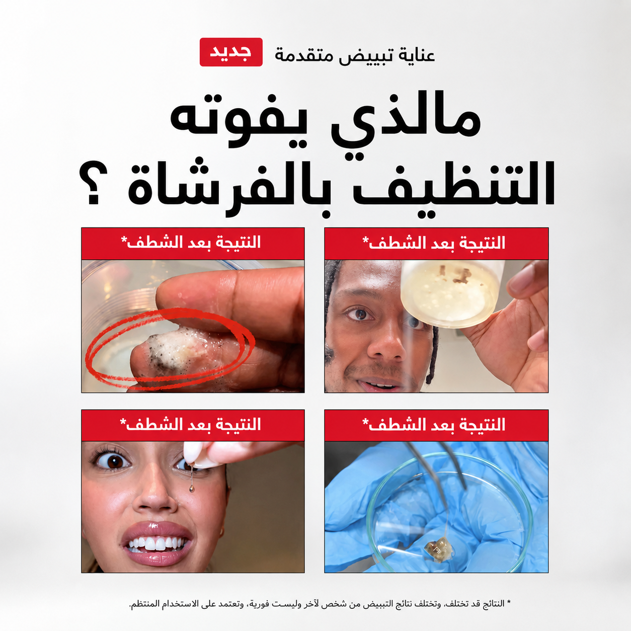غسول الفم السحري - وداعا للروائح وجير الفم والبكتيريا إلى الأبد